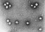 Bunyavirus