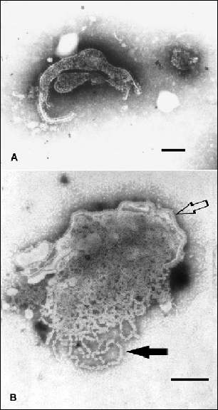 Figure. Transmission electron micrographs of Menangle virus negatively stained with 2% phosphotungstic acid. A. Depicts the pleomorphic nature of the virion; bar=100nm. B. Shows a disrupted virion, the virus envelope with surface projections (hollow arrow) and nucleocapsids (solid arrow); bar=100nm. 